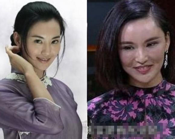 Sao Hoa ngữ thẩm mỹ: Ngày ấy - bây giờ 