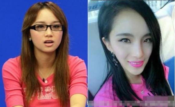 Sao Hoa ngữ thẩm mỹ: Ngày ấy - bây giờ 