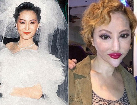 Sao Hoa ngữ thẩm mỹ: Ngày ấy - bây giờ 