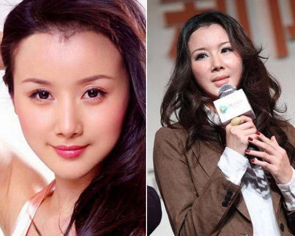 Sao Hoa ngữ thẩm mỹ: Ngày ấy - bây giờ 