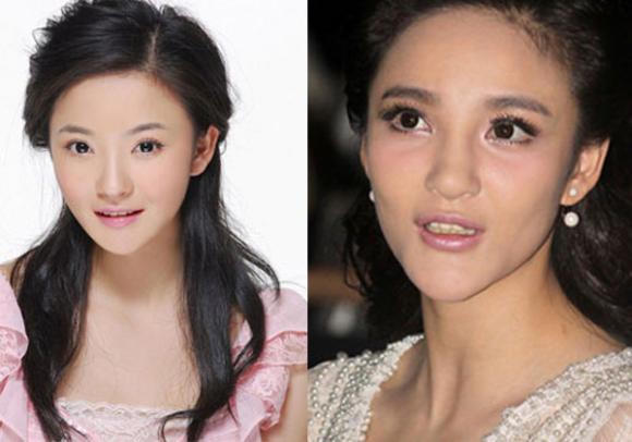 Sao Hoa ngữ thẩm mỹ: Ngày ấy - bây giờ 